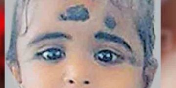 ചെറിയ മുറിപ്പാട്; 11 മാസം പ്രായമുള്ള കുട്ടി മരിച്ചു;