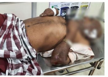പൊലീസ് ഉദ്യോഗസ്ഥൻ്റെ വാഹനമിടിച്ച് ചികിത്സയിൽ കഴിഞ്ഞിരുന്നയാൾ മരിച്ചു ﻿