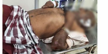 പൊലീസ് ഉദ്യോഗസ്ഥൻ്റെ വാഹനമിടിച്ച് ചികിത്സയിൽ കഴിഞ്ഞിരുന്നയാൾ മരിച്ചു ﻿