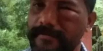 സിനിമാ ചിത്രീകരണത്തിനിടെ തേനീച്ചകളുടെ കുത്തേറ്റ് എട്ട് പേര്‍ക്ക് പരിക്ക്