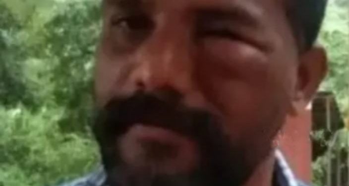 സിനിമാ ചിത്രീകരണത്തിനിടെ തേനീച്ചകളുടെ കുത്തേറ്റ് എട്ട് പേര്‍ക്ക് പരിക്ക്