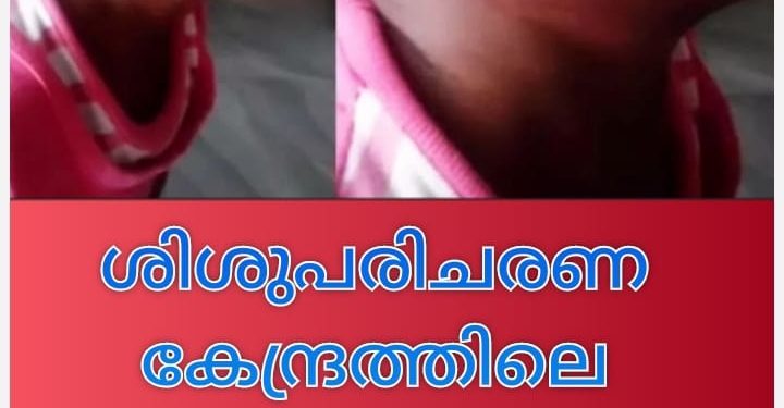 ശിശുപരിചരണ കേന്ദ്രത്തിലെ കുഞ്ഞുങ്ങള്‍ക്ക് ജില്ലാ ശിശുക്ഷേമ സമിതി സെക്രട്ടറിയുടെ മര്‍ദ്ദനം