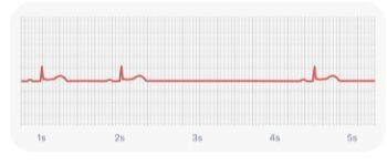 വര(ചെറുകഥ