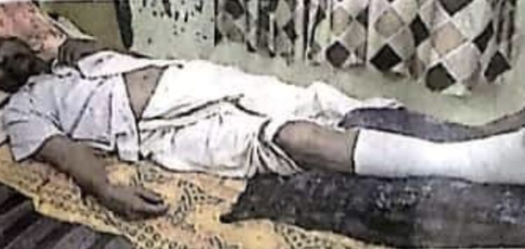 നടക്കാവ് മേല്‍പ്പാലത്തിലെ അഴുക്കുച്ചാലില്‍ വീണ് വയോധികന് പരിക്ക്.