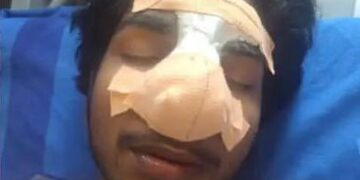 ഒറ്റപ്പാലത്ത് സഹപാഠിയുടെ ആക്രമണത്തില്‍ വിദ്യാ൪ത്ഥിക്ക് ഗുരുതര പരുക്ക്.