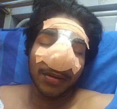 ഒറ്റപ്പാലത്ത് സഹപാഠിയുടെ ആക്രമണത്തില്‍ വിദ്യാ൪ത്ഥിക്ക് ഗുരുതര പരുക്ക്.