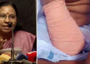 ഒമ്ബത് വയസുകാരിയുടെ കൈ മുറിച്ചുമാറ്റിയ സംഭവം: ചികിത്സാ പിഴവില്ലെന്ന് ആശുപത്രി സൂപ്രണ്ട്