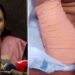 ഒമ്ബത് വയസുകാരിയുടെ കൈ മുറിച്ചുമാറ്റിയ സംഭവം: ചികിത്സാ പിഴവില്ലെന്ന് ആശുപത്രി സൂപ്രണ്ട്