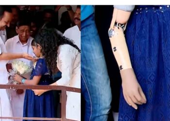 നിറപുഞ്ചിരിയോടെ വിനോദിനി ഇനി സ്‌കൂളിൽ പോകും; കൃത്രിമ കൈവെച്ചു,